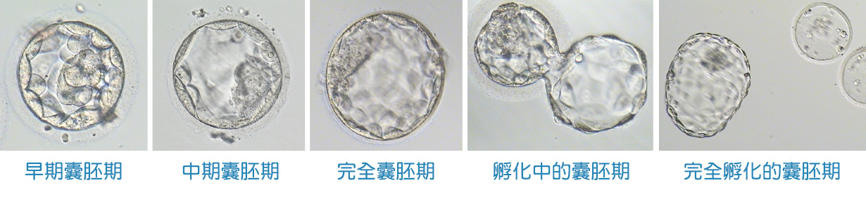  囊胚期胚胎培养-嘉安试管婴儿中心,不孕症,试管婴儿,人工受孕,冷冻卵子