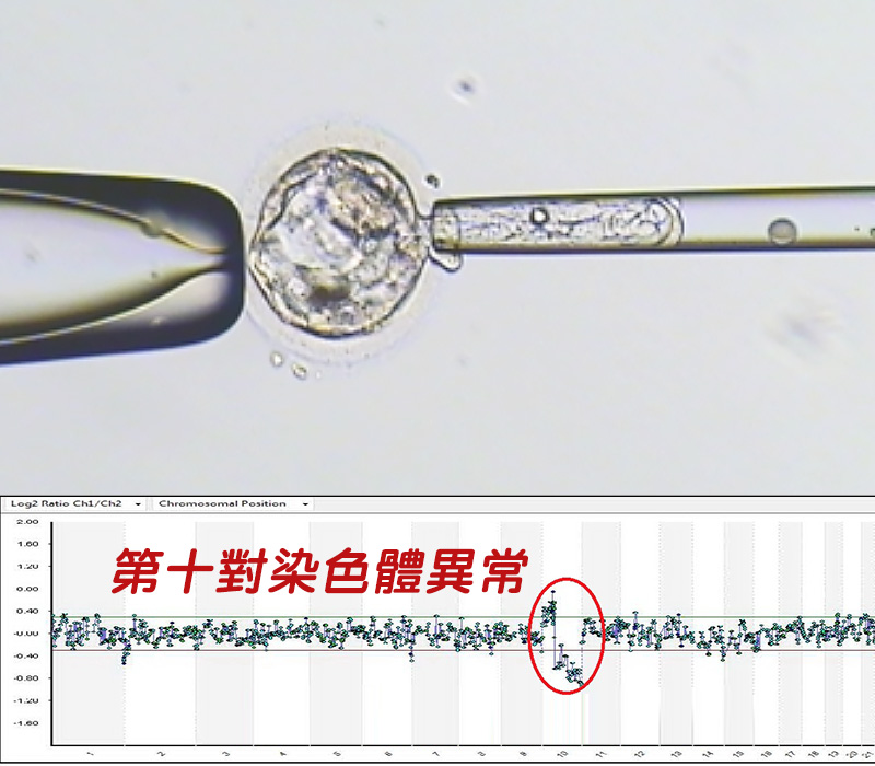 胚胎着床前染色体筛检 (PGS)-嘉安试管婴儿中心,不孕症,试管婴儿,人工受孕,冷冻卵子